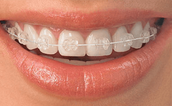 best orthodontist in chennai, Home, Chennai Orthodontics